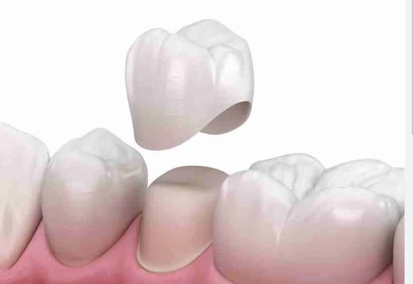 Mơ thấy rụng răng một số ý nghĩa khác