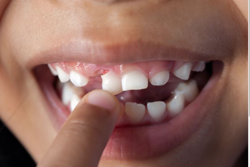Tổng hợp bộ số khi nằm mơ thấy rụng răng